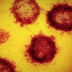 コロナウイルスに見る決断できない日本の体質